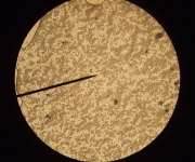 Candida yeast infection treatment