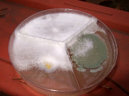 The best scalp fungus treatment